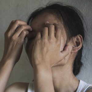 The emerging role of esketamine for chronic pain